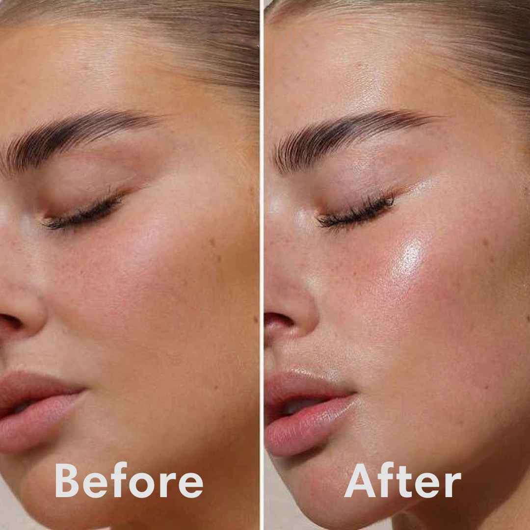 Youthful Glow™ Miracle Mask